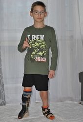 Zdjęcie przedstawia chłopca w protezie nogi
