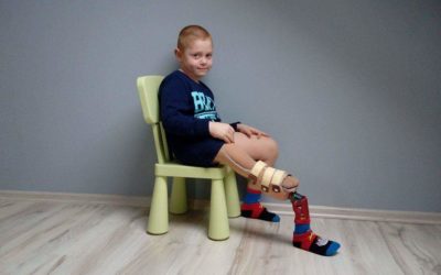 Zdjęcie przedstawia chłopczyka siedzącego z ortezą na nodze